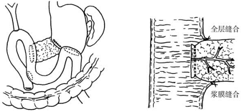 pagenumber_ebook=147,pagenumber_book=132