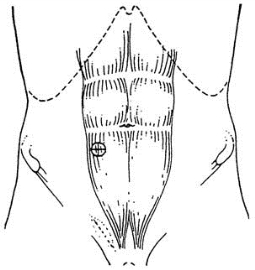 pagenumber_ebook=170,pagenumber_book=155