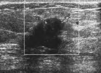 pagenumber_ebook=171,pagenumber_book=171