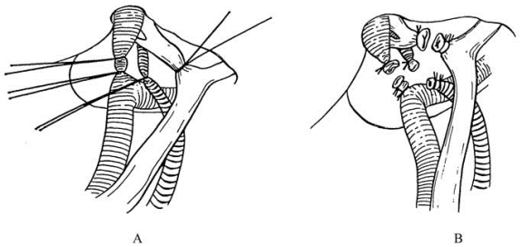 pagenumber_ebook=471,pagenumber_book=456