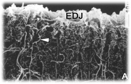 3.2-2 成牙本质细胞突起.jpg