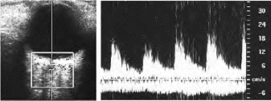 pagenumber_ebook=111,pagenumber_book=111