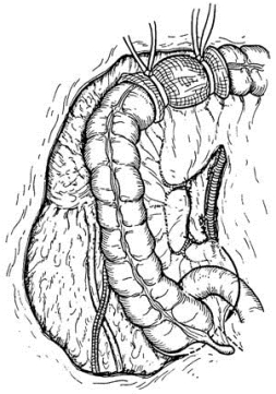 pagenumber_ebook=394,pagenumber_book=379