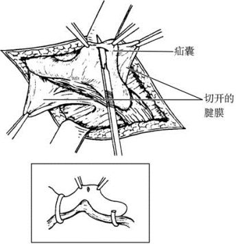 pagenumber_ebook=588,pagenumber_book=573