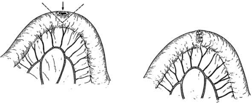 pagenumber_ebook=569,pagenumber_book=554