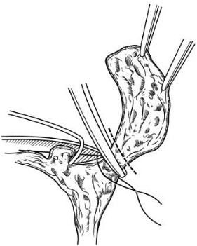 pagenumber_ebook=606,pagenumber_book=591
