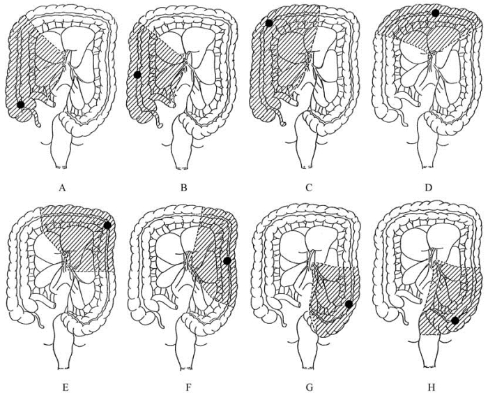 pagenumber_ebook=193,pagenumber_book=178