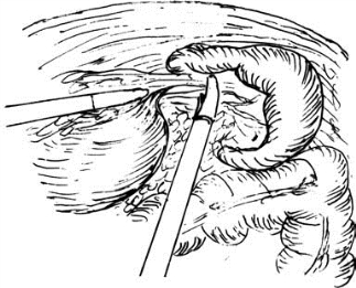 pagenumber_ebook=515,pagenumber_book=500