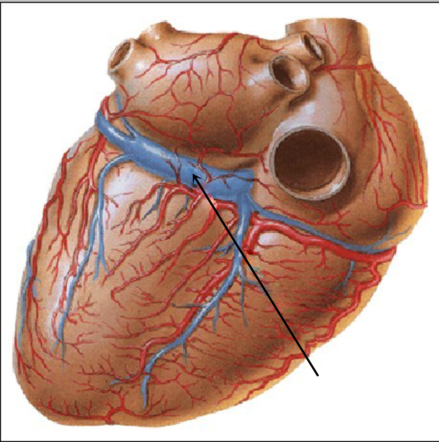 冠状窦(血管名称).jpg