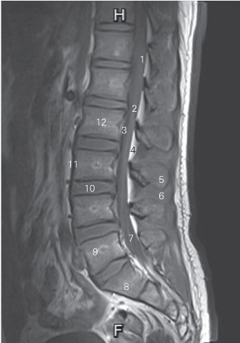 pagenumber_ebook=32,pagenumber_book=23