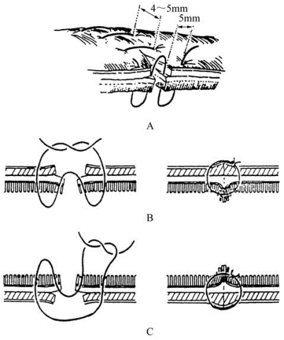 pagenumber_ebook=138,pagenumber_book=123