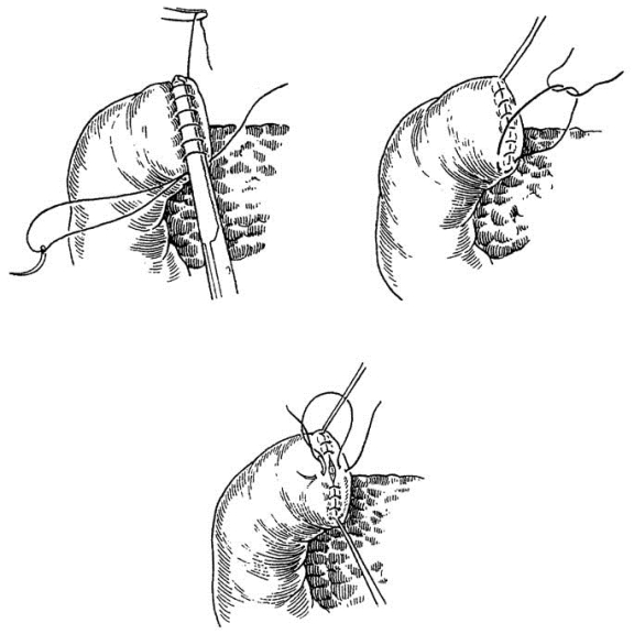 pagenumber_ebook=327,pagenumber_book=312