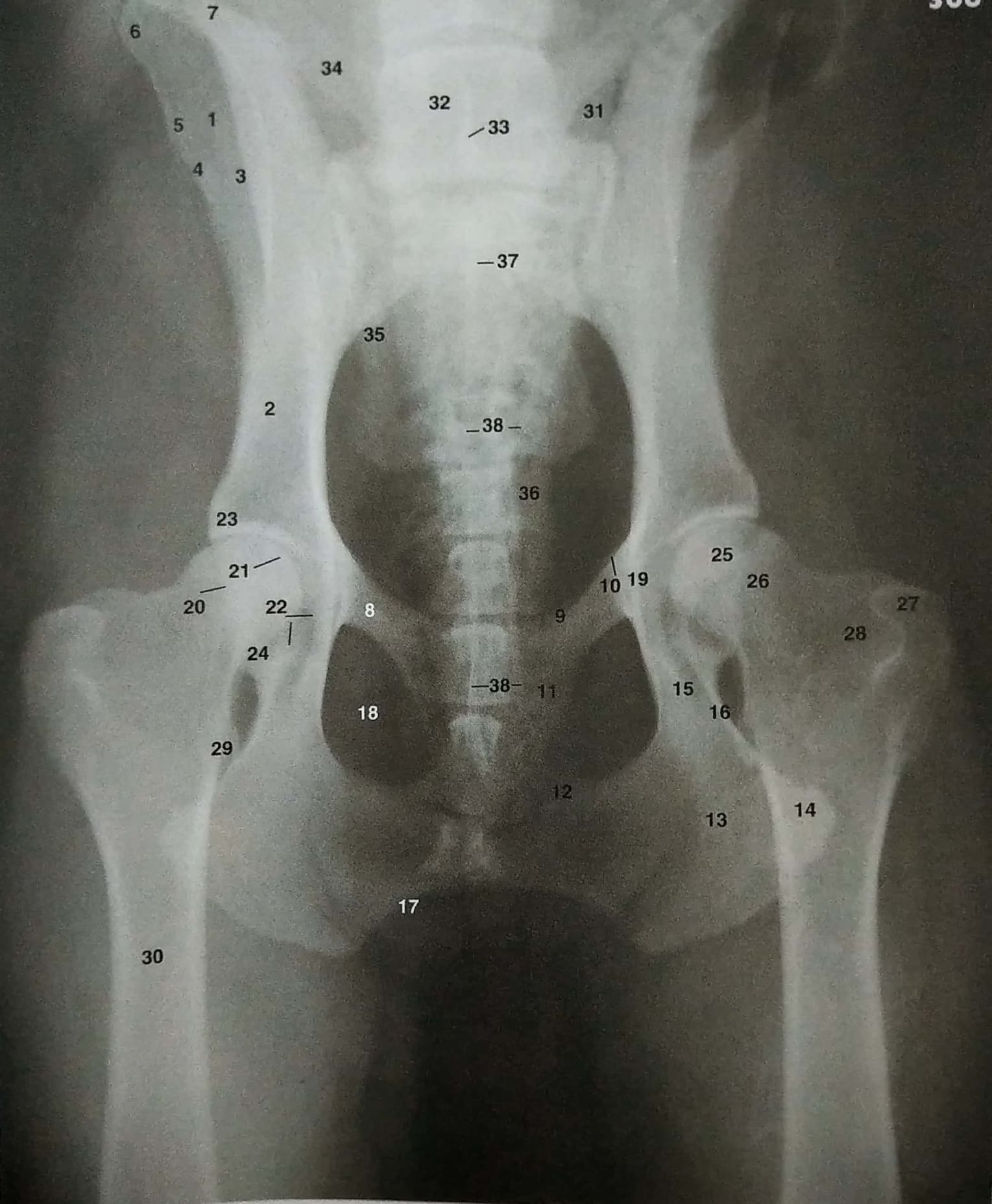 以下x光片图片中哪个是膝关节