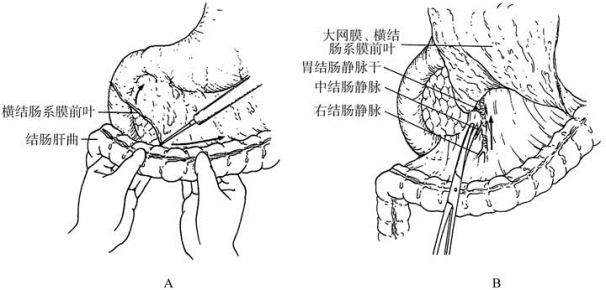 pagenumber_ebook=336,pagenumber_book=321