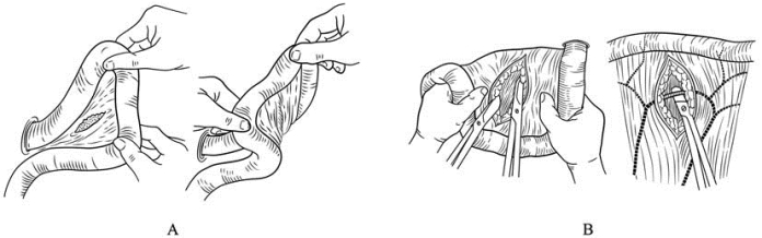 pagenumber_ebook=248,pagenumber_book=233