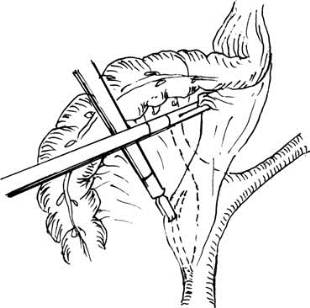 pagenumber_ebook=425,pagenumber_book=410