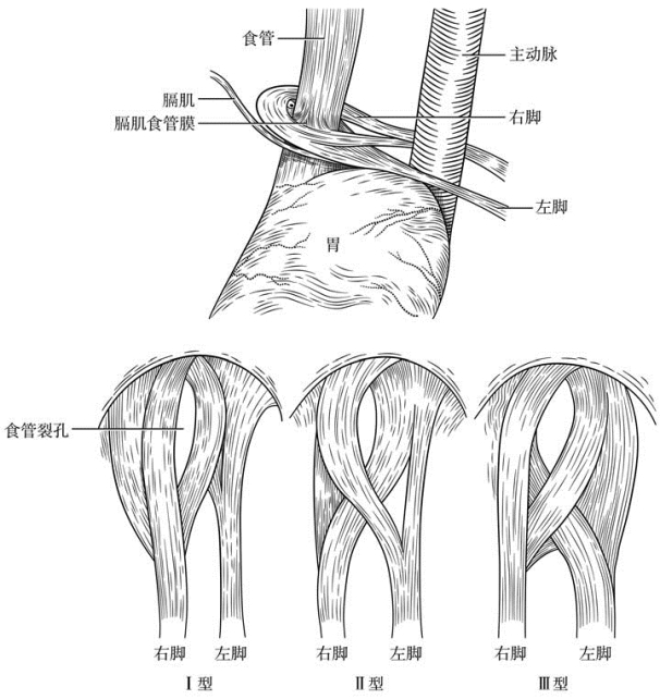 pagenumber_ebook=307,pagenumber_book=292