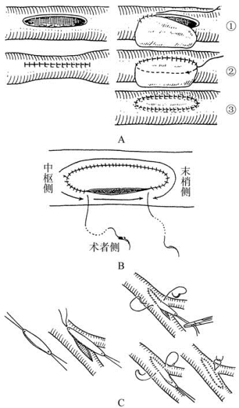 pagenumber_ebook=261,pagenumber_book=246