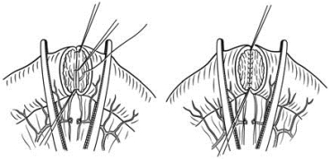 pagenumber_ebook=367,pagenumber_book=352