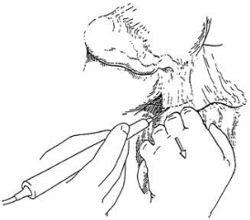 pagenumber_ebook=96,pagenumber_book=81