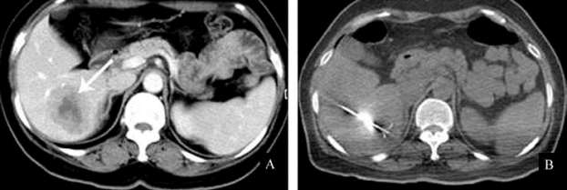 pagenumber_ebook=290,pagenumber_book=275