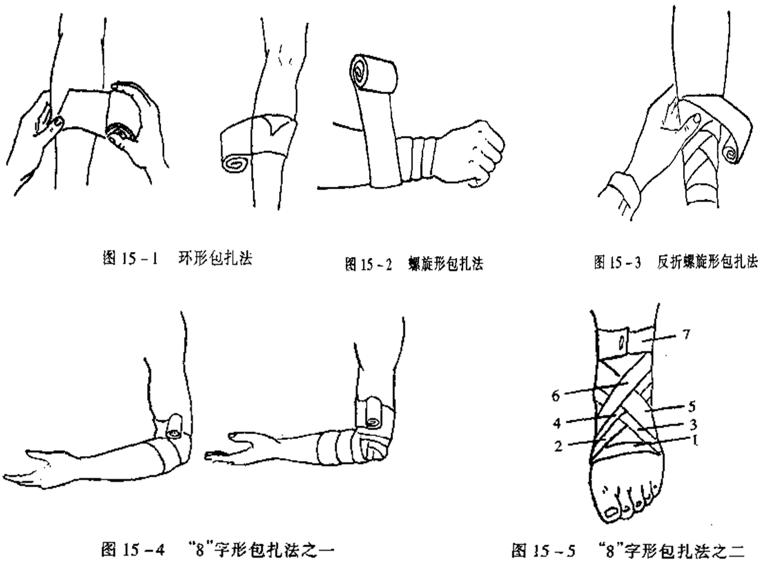 螺旋形包扎法:用于包扎肢体粗细差不多的部位,如上臂,大腿下段和手指