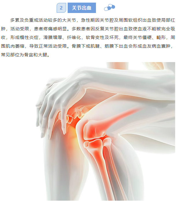 image.png?v=1777161396972