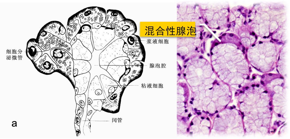 6.1-4 混合性腺泡.jpg