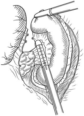 pagenumber_ebook=514,pagenumber_book=499