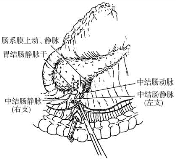 pagenumber_ebook=194,pagenumber_book=179