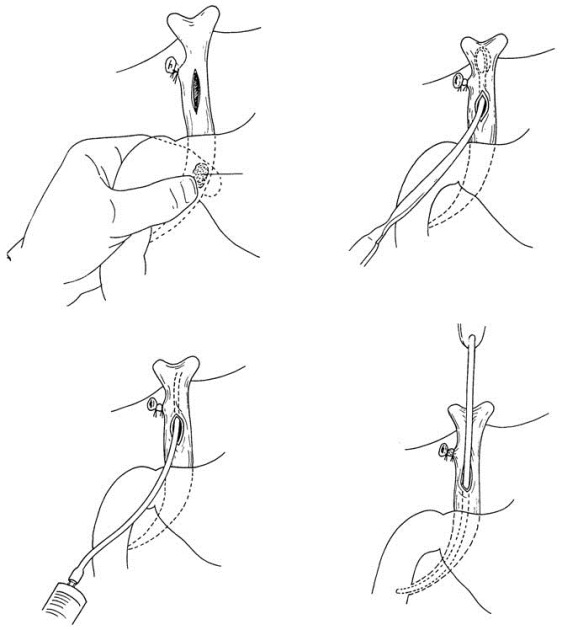 pagenumber_ebook=438,pagenumber_book=423