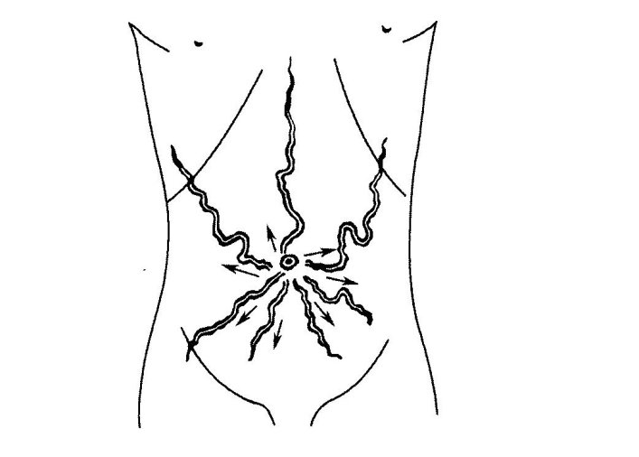 37.png