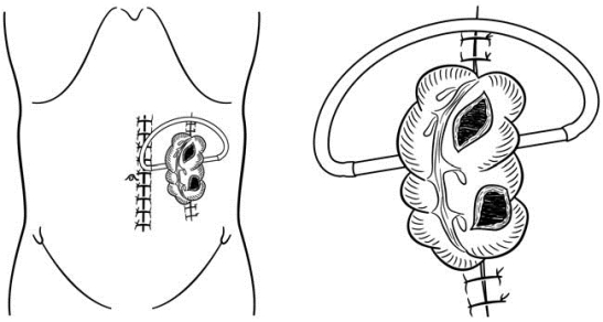pagenumber_ebook=571,pagenumber_book=556