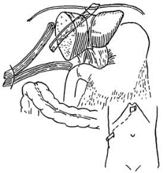 pagenumber_ebook=166,pagenumber_book=151