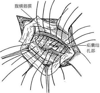 pagenumber_ebook=597,pagenumber_book=582