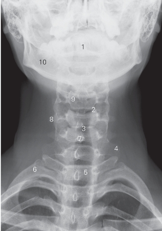 pagenumber_ebook=156,pagenumber_book=147