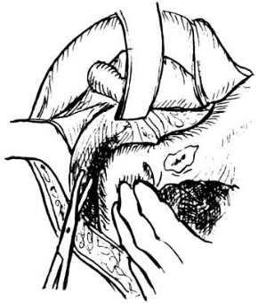 pagenumber_ebook=563,pagenumber_book=548