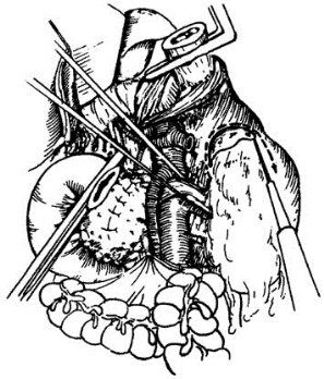 pagenumber_ebook=364,pagenumber_book=349