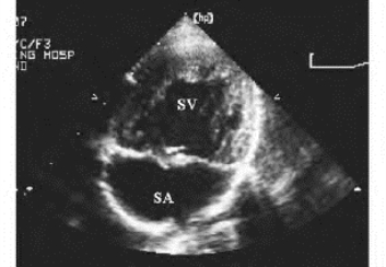 pagenumber_ebook=388,pagenumber_book=388