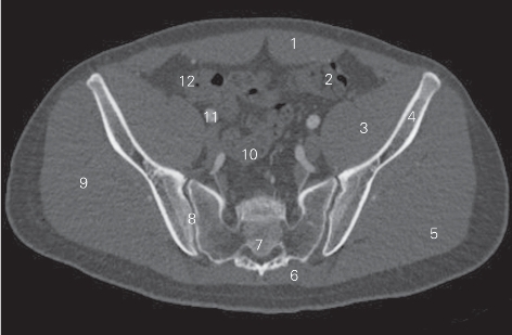 pagenumber_ebook=92,pagenumber_book=83