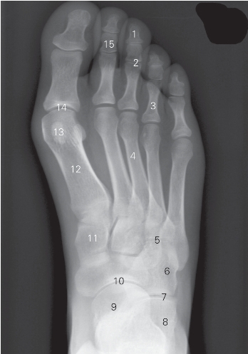pagenumber_ebook=170,pagenumber_book=161