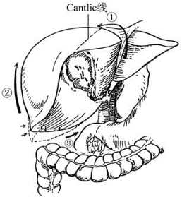 pagenumber_ebook=471,pagenumber_book=456
