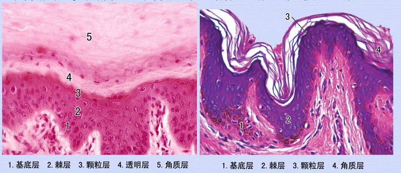 表皮的分层与角化.png