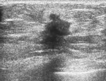 pagenumber_ebook=170,pagenumber_book=170