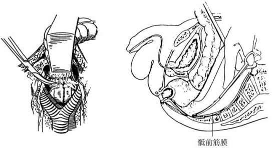 pagenumber_ebook=409,pagenumber_book=394