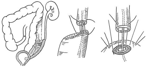 pagenumber_ebook=243,pagenumber_book=228