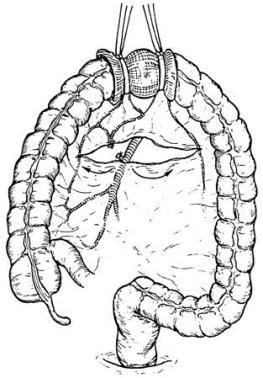 pagenumber_ebook=384,pagenumber_book=369