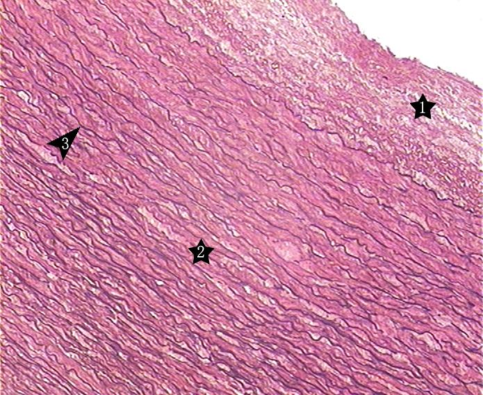 大动脉壁   三色法染色    40×大动脉壁    三色法染色    100  ×