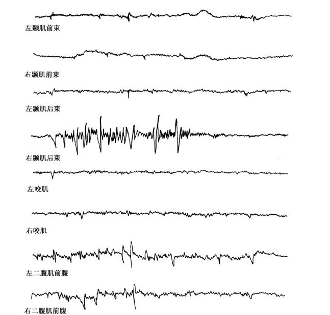 pagenumber_ebook=157,pagenumber_book=148