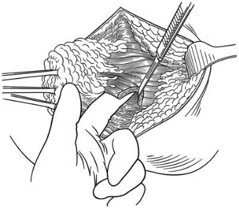 pagenumber_ebook=412,pagenumber_book=397